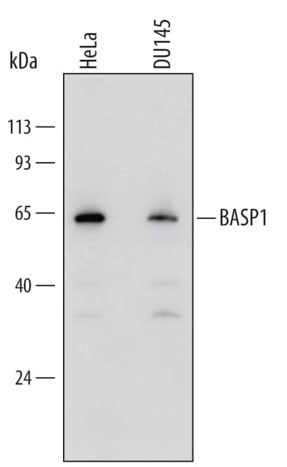 Western blot shows lysates of HeLa human cervical epithelial carcinoma cell line and DU145 human prostate carcinoma cell line. PVDF Membrane was probed with 1 µg/mL of Human BASP1 Antigen Affinity-purified Polyclonal Antibody (Catalog # AF6479) followed by HRP-conjugated Anti-Sheep IgG Secondary Antibody (Catalog # HAF016). A specific band was detected for BASP1 at approximately 60 kDa, possibly a higher molecular weight isoform or a product of SUMOyation. Lower molecular weight isoforms were also observed. This experiment was conducted under reducing conditions on a 4-20% SDS-PAGE gel and using Immunoblot Buffer Group 1.