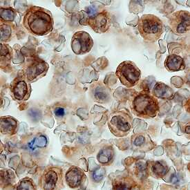 BIML was detected in immersion fixed paraffin-embedded sections of human spleen using Goat Anti-Human BIML Long (BIM L) Antigen Affinity-purified Polyclonal Antibody (Catalog # AF1325) at 15 µg/mL overnight at 4 °C. Before incubation with the primary antibody, tissue was subjected to heat-induced epitope retrieval using Antigen Retrieval Reagent-Basic (Catalog # CTS013). Tissue was stained using the Anti-Goat HRP-DAB Cell & Tissue Staining Kit (brown; Catalog # CTS008) and counterstained with hematoxylin (blue). Specific staining was localized to the cytoplasm and perinuclear area in monocytes. View our protocol for Chromogenic IHC Staining of Paraffin-embedded Tissue Sections.