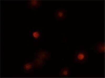 Immunocytochemistry/Immunofluorescence: BMI-1 Antibody [NBP2-24693] - Immunofluorescence of BMI1 in human oral squamous cell carcinoma (UPCI:SCC029B) cells. These cells are part of a large collection of HNSCC (head and neck SCC) lines established by the Gollin lab (White et al., 2007). The BMI1 antibody was used at 5 ug/ml. Staining is primarily nuclear, some cytoplasmic staining is also observed. Data courtesy of Hatem Kaseb, MD and Susanne M. Gollin, PhD.