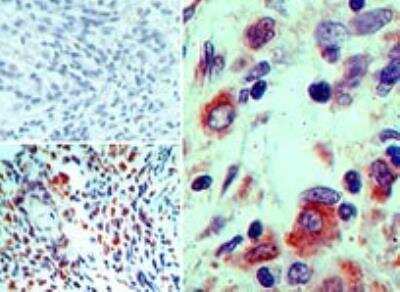 Immunohistochemistry-Paraffin: BMI-1 Antibody [NBP2-24693] - Analysis of BMI1 in formalin-fixed, paraffin-embedded human cervix tissue using an isotype control (top left) and this antibody (bottom left, right) at 5 ug/ml.