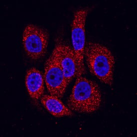 BMPR-IB/ALK-6 was detected in immersion fixed PC-3 human prostate cancer cell line using Mouse Anti-Human BMPR-IB/ALK-6 Monoclonal Antibody (Catalog # MAB5051) at 10 µg/mL for 3 hours at room temperature. Cells were stained using the NorthernLights™ 557-conjugated Anti-Mouse IgG Secondary Antibody (red; Catalog # NL007) and counterstained with DAPI (blue). Specific staining was localized to the cytoplasm and cell surface. View our protocol for Fluorescent ICC Staining of Cells on Coverslips.