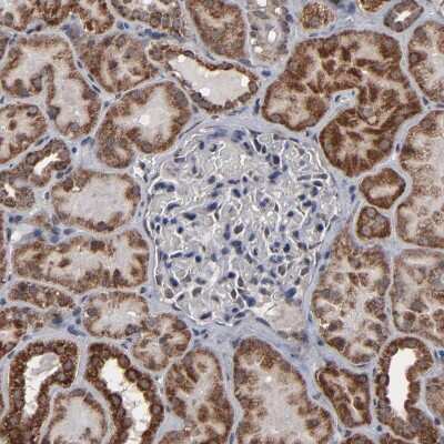 Immunohistochemistry-Paraffin: BNIP3 Antibody [NBP1-82566] - Staining of human kidney shows strong granular cytoplasmic positivity in cells in tubules.