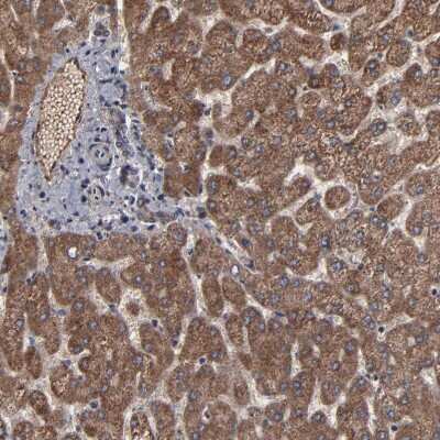 Immunohistochemistry-Paraffin: BNIP3 Antibody [NBP1-82566] - Staining of human liver shows strong granular cytoplasmic positivity in hepatocytes.