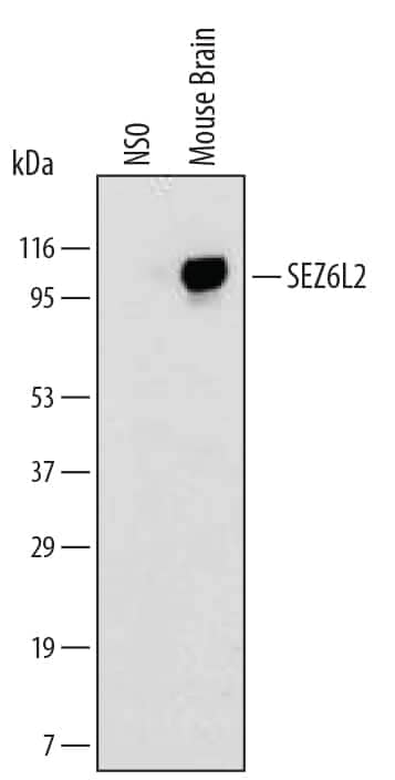 Western Blot SEZ6L2/BSRP-A Antibody (529805) [Unconjugated]