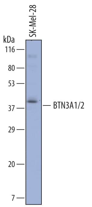 Western Blot BTN3A1/2/3 Antibody [Unconjugated]
