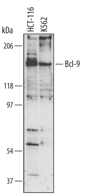 Western blot shows lysates of HCT-116 human colorectal carcinoma cell line and K562 human chronic myelogenous leukemia cell line. PVDF membrane was probed with 0.5 µg/mL of Human Bcl-9 Monoclonal Antibody (Catalog # MAB3996) followed by HRP-conjugated Anti-Mouse IgG Secondary Antibody (Catalog # HAF007). A specific band was detected for Bcl-9 at approximately 150 kDa (as indicated). This experiment was conducted under reducing conditions and using Immunoblot Buffer Group 1.