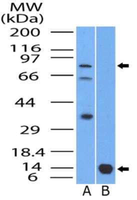 Western Blot: Bcl6 Antibody [NBP2-31369] - WB detection of B-cell lymphoma 6 / Bcl6 protein in (A) lysate of Ramos /human Burkitt's lymphoma cell line and (B) partial recombinant protein using Bcl6 antibody at a concentration of: 2ug/ml for lysate, and 0.5ug/ml for recombinant protein. In Ramos cells, this antibody detected a specific band below ~80 kDa (predicted size 78.9 kDa) and two additional bands ~60kDa/35kDa which are potentially the polyubiquitinization degradation fragments of this protein. 