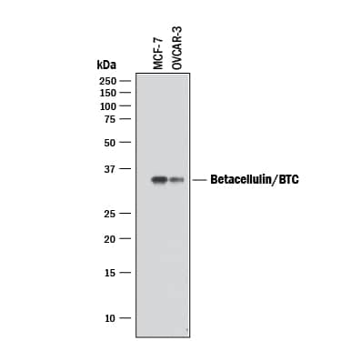 Western blot shows lysates of MCF-7 human breast cancer cell line and OVCAR-3 human ovarian carcinoma cell line. PVDF membrane was probed with 2 µg/mL of Goat Anti-Human Betacellulin/BTC Antigen Affinity-purified Polyclonal Antibody (Catalog # AF-261-NA) followed by HRP-conjugated Anti-Goat IgG Secondary Antibody (Catalog # HAF017). A specific band was detected for Betacellulin/BTC at approximately 32 kDa (as indicated). This experiment was conducted under reducing conditions and using Immunoblot Buffer Group 1.