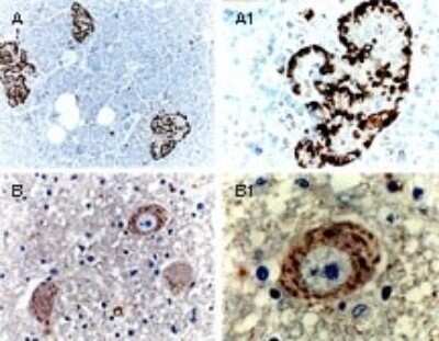 Immunohistochemistry-Paraffin: BID Antibody [NB100-56108] - Bid Antibody [NB100-56108] - Used at 1:2000 to stain Human tissue sections. A) and Adult Pancreas B) Adult mesencephalon (midbrain). A1 and B1 are higher magnifications of A and B, respectively. Hematoxylin-eosin counterstain