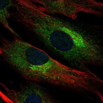 Immunocytochemistry/Immunofluorescence: Biglycan Antibody [NBP1-84971] - Staining of human cell line BJ shows localization to endoplasmic reticulum &amp; the Golgi apparatus. Antibody staining is shown in green.