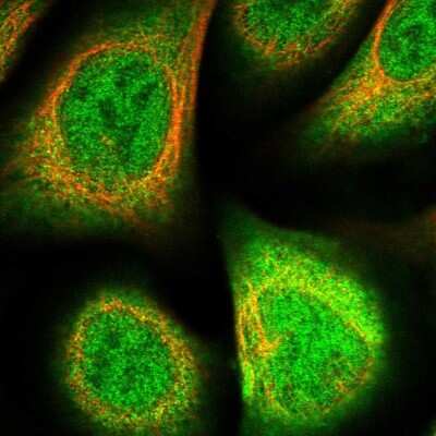 Immunocytochemistry/Immunofluorescence: Biliverdin Reductase B/BLVRB Antibody [NBP1-83435] - Staining of human cell line U-2 OS shows localization to nucleoplasm &amp; cytosol. Antibody staining is shown in green.