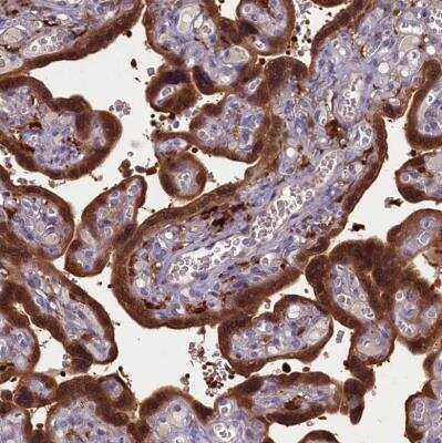 Immunohistochemistry-Paraffin: Biliverdin Reductase B/BLVRB Antibody [NBP1-83435] - Staining of human placenta shows moderate to strong cytoplasmic positivity in trophoblastic cells.
