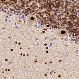        Brg1  was detected in immersion fixed paraffin-embedded sections of human brain  (cerebellum) using Rabbit Anti-Human Brg1 Monoclonal Antibody (Catalog #  MAB5738) at 1 µg/mL for 1 hour at room temperature  followed by incubation with the Anti-Rabbit IgG VisUCyte™ HRP  Polymer Antibody (Catalog # VC003).  Tissue was stained using DAB (brown) and counterstained with hematoxylin  (blue).  Specific staining was  localized to neuronal nuclei. View our protocol for IHC  Staining with VisUCyte HRP Polymer Detection Reagents. 