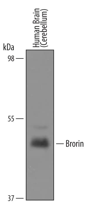 Western blot shows lysates of human brain (cerebellum) tissue. PVDF Membrane was probed with 1 µg/mL of Sheep Anti-Human Brorin/VWC2 Antigen Affinity-purified Polyclonal Antibody (Catalog # AF6147) followed by HRP-conjugated Anti-Sheep IgG Secondary Antibody (Catalog # HAF016). A specific band was detected for Brorin/VWC2 at approximately 46kDa (as indicated). This experiment was conducted under reducing conditions and using Immunoblot Buffer Group 8.