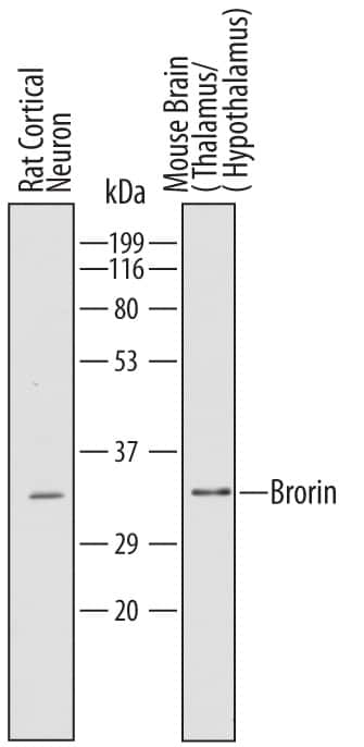 Western blot shows lysates of rat cortical neuron tissue and mouse brain (thalamus/hypothalamus) tissue. PVDF Membrane was probed with 1 µg/mL of Sheep Anti-Mouse Brorin/VWC2 Antigen Affinity-purified Polyclonal Antibody (Catalog # AF6730) followed by HRP-conjugated Anti-Sheep IgG Secondary Antibody (Catalog # HAF016). A specific band was detected for Brorin/VWC2 at approximately 35 kDa (as indicated). This experiment was conducted under reducing conditions and using Immunoblot Buffer Group 1.