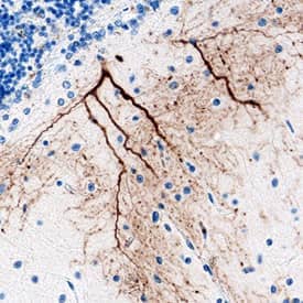 Brorin/VWC2 was detected in immersion fixed paraffin-embedded sections of human brain (cerebellum) using Mouse Anti-Human Brorin/VWC2 Monoclonal Antibody (Catalog # MAB6147) at 15 µg/mL overnight at 4 °C. Tissue was stained using the Anti-Mouse HRP-DAB Cell & Tissue Staining Kit (brown; Catalog # CTS002) and counter-stained with hematoxylin (blue). Specific staining was localized to cytoplasm in neurons. View our protocol for Chromogenic IHC Staining of Paraffin-embedded Tissue Sections.