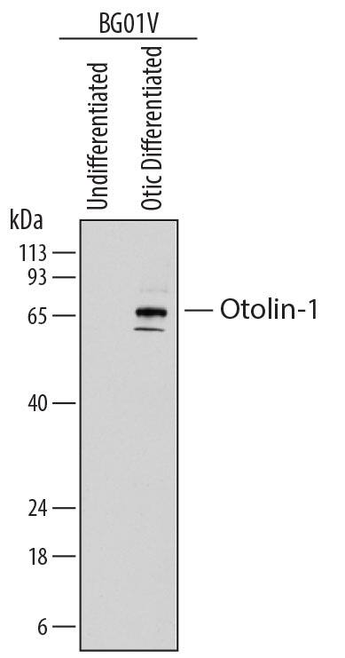 Western blot shows lysates of BG01V human embryonic stem cells undifferentiated or differentiated to early otic lineage. PVDF membrane was probed with 0.25 µg/mL of Mouse Anti-Human Otolin-1 Monoclonal Antibody (Catalog # MAB8045) followed by HRP-conjugated Anti-Mouse IgG Secondary Antibody (Catalog # HAF018). Specific bands were detected for Otolin-1 at approximately 60-70 kDa (as indicated). This experiment was conducted under reducing conditions and using Immunoblot Buffer Group 1.