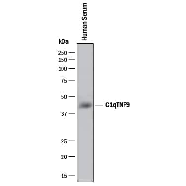 Western blot shows human serum. PVDF membrane was probed with 2 µg/mL of Sheep Anti-Human CTRP9/C1qTNF9 Antigen Affinity-purified Polyclonal Antibody (Catalog # AF6537) followed by HRP-conjugated Anti-Sheep IgG Secondary Antibody (Catalog # HAF016). A specific band was detected for CTRP9/C1qTNF9 at approximately 42 kDa (as indicated). This experiment was conducted under reducing conditions and using Immunoblot Buffer Group 1.