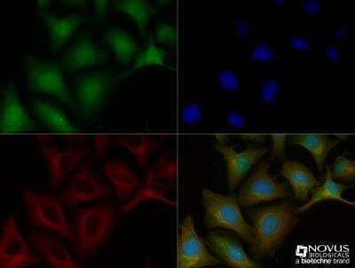 Immunocytochemistry/Immunofluorescence: C9orf72 Antibody [NBP2-47146] - HeLa cells were fixed for 10 minutes using 10% formalin and then permeabilized for 5 minutes using 1X TBS + 0.5% Triton-X100. The cells were incubated with anti-C9orf72 (NBP2-47146) at a 1:100 dilution overnight at 4C and detected with an anti-rabbit Dylight 488 (Green) at a 1:500 dilution. Alpha tubulin (DM1A) NB100-690 was used as a co-stain at a 1:1000 dilution and detected with an anti-mouse Dylight 550 (Red) at a 1:500 dilution. Nuclei were counterstained with DAPI (Blue). Cells were imaged using a 40X objective. 