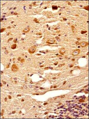 Immunohistochemistry-Paraffin: C9orf72 Antibody [NBP2-47146] - IHC analysis of a formalin fixed paraffin embedded tissue section of mouse brain using C9orf72 antibody (NBP2-47146) at 1:300 dilution with HRP-DAB detection and hematoxylin counterstaining. The antibody generated strong/specific cytoplasmic signal in the neurons and other cell types in the tested section.