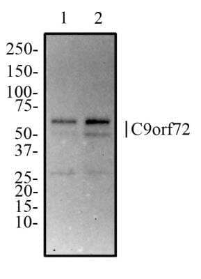 Western Blot: C9orf72 Antibody [NBP2-47146] - Western Blot Image of anti-C9orf72. Whole cell protein from SK-N-SH (lane 1) and SH-SY-5Y (lane 2) was separated on a 4-15% gel by SDS-PAGE, transferred to PVDF membrane and blocked in 5% non-fat milk in TBST. The membrane was probed with 2.0 ug/ml anti-hnRNP in 1% milk, and detected with an anti-rabbit HRP secondary antibody using chemiluminescence.