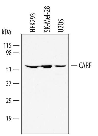 Western Blot CARF/CDKN2AIP Antibody