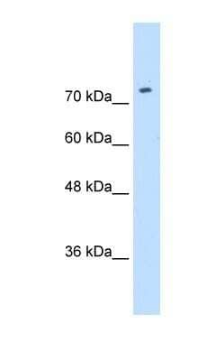 Western Blot CAT1 Antibody