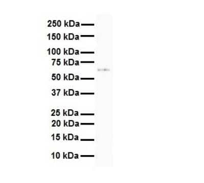 Western Blot CAT1 Antibody