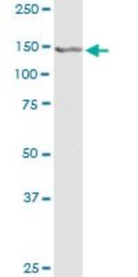 Western Blot: CBF2 Antibody [H00010153-B01P] - Analysis of CEBPZ expression in PC-12.