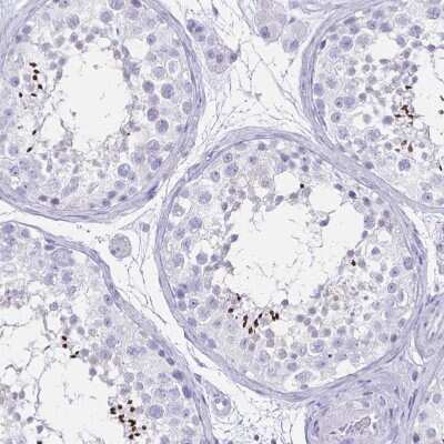 Immunohistochemistry-Paraffin: CCDC39 Antibody [NBP1-90560] - Staining of human testis shows strong cytoplasmic positivity in spermatozoa.