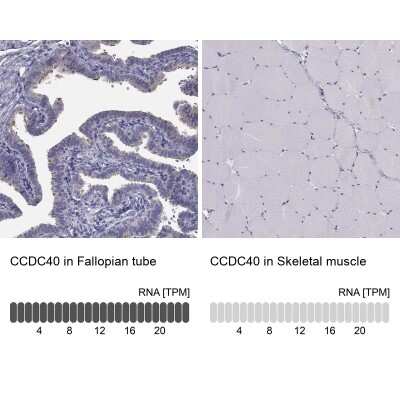 Immunohistochemistry-Paraffin: CCDC40 Antibody [NBP1-82162] - Staining in human fallopian tube and skeletal muscle tissues using anti-CCDC40 antibody. Corresponding CCDC40 RNA-seq data are presented for the same tissues.