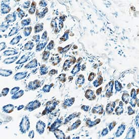 CCL11/Eotaxin was detected in perfusion fixed frozen sections of mouse colon using Goat Anti-Mouse CCL11/Eotaxin Biotinylated Antigen Affinity-purified Polyclonal Antibody (Catalog # BAF420) at 15 µg/mL overnight at 4 °C. Tissue was stained using the Anti-Goat HRP-DAB Cell & Tissue Staining Kit (brown; Catalog # CTS008) and counterstained with hematoxylin (blue). Specific staining was localized to cytoplasm. View our protocol for Chromogenic IHC Staining of Frozen Tissue Sections.