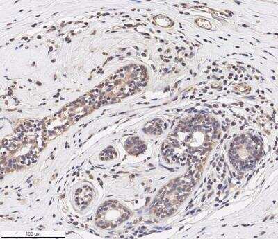 CCL2/MCP1 Antibody - BSA Free (NBP1-07035): Novus Biologicals