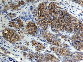 CCL20/MIP‑3a was detected in immersion fixed paraffin-embedded sections of human lymph node using 15 µg/mL Goat Anti-Human CCL20/MIP‑3a Biotinylated Antigen Affinity-purified Polyclonal Antibody (Catalog # BAF360) overnight at 4 °C. Tissue was stained with the Anti-Goat HRP-DAB Cell & Tissue Staining Kit (brown; Catalog # CTS008) and counterstained with hematoxylin (blue). View our protocol for Chromogenic IHC Staining of Paraffin-embedded Tissue Sections.