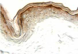 CCL24/Eotaxin‑2/MPIF‑2 was detected in immersion fixed paraffin-embedded sections of human skin using 15 µg/mL Goat Anti-Human CCL24/Eotaxin‑2/MPIF‑2 Antigen Affinity-purified Polyclonal Antibody (Catalog # AF343) overnight at 4 °C. Tissue was stained with the Anti-Goat HRP-DAB Cell & Tissue Staining Kit (brown; Catalog # CTS008) and counterstained with hematoxylin (blue). View our protocol for Chromogenic IHC Staining of Paraffin-embedded Tissue Sections.