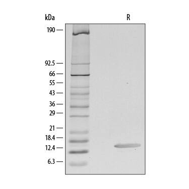 1 μg/lane of Recombinant Human CCL28 was resolved with SDS-PAGE under reducing (R) conditions and visualized by silver staining, showing a single band at 14 kDa.