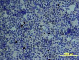 CCL4/MIP-1 beta  was detected in immersion fixed frozen sections of mouse spleen using Mouse CCL4/MIP-1 beta  Biotinylated Antigen Affinity-purified Polyclonal Antibody (Catalog # BAF451) at 15 µg/mL overnight at 4 °C. Tissue was stained using the Anti-Goat HRP-DAB Cell & Tissue Staining Kit (brown; Catalog # CTS008) and counterstained with hematoxylin (blue). View our protocol for Chromogenic IHC Staining of Frozen Tissue Sections.