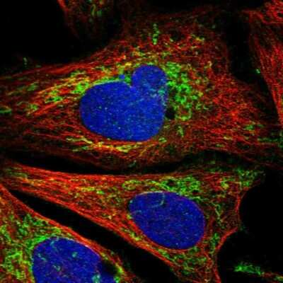 Immunocytochemistry/Immunofluorescence: CCM2 Antibody [NBP1-86730] - Staining of human cell line U-2 OS shows localization to mitochondria. Antibody staining is shown in green.