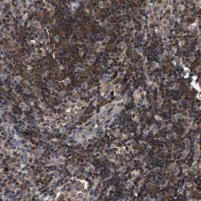 Immunohistochemistry-Paraffin: CCM2 Antibody [NBP1-86730] - Staining of human lymph node shows high expression.