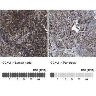 Immunohistochemistry-Paraffin: CCM2 Antibody [NBP1-86730] - Staining in human lymph node and pancreas tissues using anti-CCM2 antibody. Corresponding CCM2 RNA-seq data are presented for the same tissues.