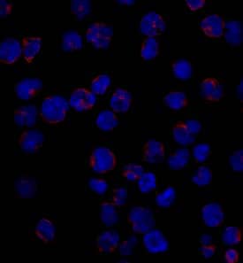 CD1a was detected in immersion fixed MOLT-4 human acute lymphoblastic leukemia cell line using Mouse Anti-Human CD1a Monoclonal Antibody (Catalog # MAB7076) at 10 µg/mL for 3 hours at room temperature. Cells were stained using the NorthernLights™ 557-conjugated Anti-Mouse IgG Secondary Antibody (red; NL007) and counterstained with DAPI (blue). Specific staining was localized to surface and cytoplasm. View our protocol for Fluorescent ICC Staining of Non-adherent Cells.