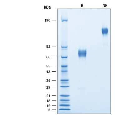 2 μg/lane of Recombinant Mouse CD200R1L Fc Chimera was resolved with SDS-PAGE under reducing (R) and non-reducing (NR) conditions and visualized by Coomassie® blue staining, showing bands at 65-85 kDa and 130-170 kDa, respectively. 
