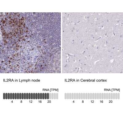 <b>Orthogonal Strategies Validation. </b>Immunohistochemistry-Paraffin: CD25/IL-2R alpha Antibody [NBP2-38730] - CD25/IL-2 R alpha Antibody [NBP2-38730] - Analysis in human lymph node and cerebral cortex tissues. Corresponding IL2RA RNA-seq data are presented for the same tissues.