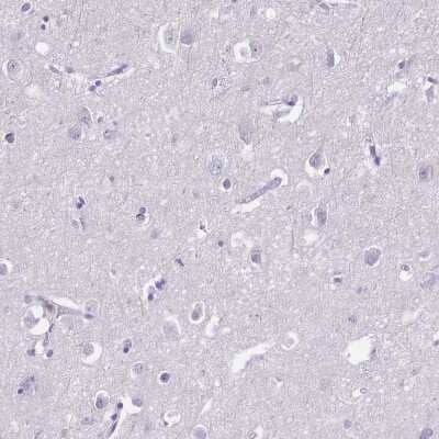 Immunohistochemistry-Paraffin: CD25/IL-2 R alpha Antibody [NBP2-38730] - Staining of human cerebral cortex shows no positivity in neurons as expected.