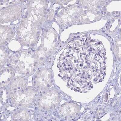 Immunohistochemistry-Paraffin: CD25/IL-2 R alpha Antibody [NBP2-38730] - Staining of human kidney shows no positivity in cells in tubules as expected.