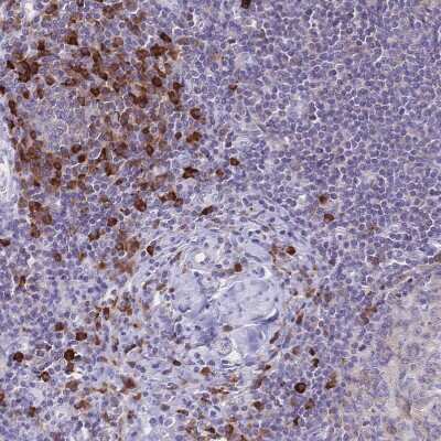 Immunohistochemistry-Paraffin: CD25/IL-2 R alpha Antibody [NBP2-38730] - Staining of human lymph node shows strong membranous positivity in non-germinal center cells.