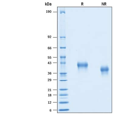 2 μg/lane of Recombinant Human CD25/IL-2R alpha His-tag (Catalog # 10305-RL) was  resolved with SDS-PAGE under reducing (R) and non-reducing (NR)  conditions and visualized by Coomassie® Blue staining, showing bands at 35-43 kDa.