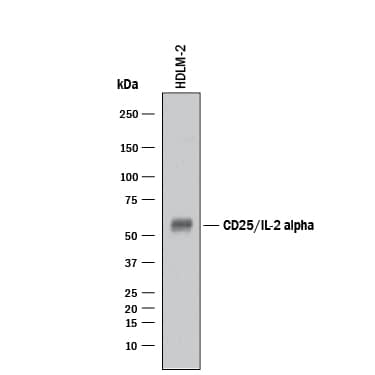 Western blot shows lysates of HDLM-2 human Hodgkin's lymphoma cell line. PVDF membrane was probed with 1 µg/mL of Rabbit Anti-Human CD25/IL-2R alpha Monoclonal Antibody (Catalog # MAB10201) followed by HRP-conjugated Anti-Rabbit IgG Secondary Antibody (Catalog # HAF008). A specific band was detected for CD25/IL-2R alpha at approximately 60 kDa (as indicated). This experiment was conducted under reducing conditions and using Immunoblot Buffer Group 1.