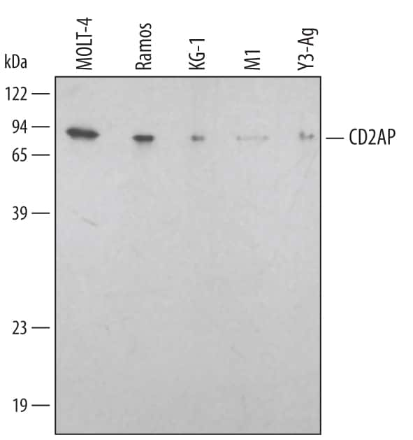 Western blot shows lysates of MOLT-4 human acute lymphoblastic leukemia cell line, Ramos human Burkitt's lymphoma cell line, KG-1 human acute myelogenous leukemia cell line, M1 mouse myeloid leukemia cell line, and Y3-Ag rat myeloid cell line. PVDF membrane was probed with 0.2 µg/mL of Human/Mouse/Rat CD2AP Antigen Affinity-purified Polyclonal Antibody (Catalog # AF4474) followed by HRP-conjugated Anti-Sheep IgG Secondary Antibody (Catalog # HAF016). A specific band was detected for CD2AP at approximately 80 kDa (as indicated). This experiment was conducted under reducing conditions and using Immunoblot Buffer Group 1.