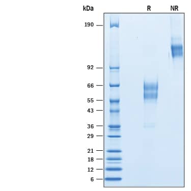 2 μg/lane of Recombinant Human CD300d Fc Chimera (Catalog # 10273-CD) was  resolved with SDS-PAGE under reducing (R) and non-reducing (NR)  conditions and visualized by Coomassie® Blue staining, showing bands at 50-70 kDa and 100-140 kDa, respectively.